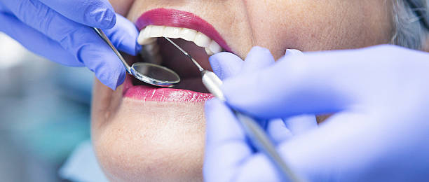 Best Emergency Dental Services Near Me  in Mission Nyon, CA